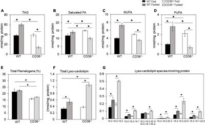 Cardiac immune cell infiltration associates with abnormal lipid metabolism